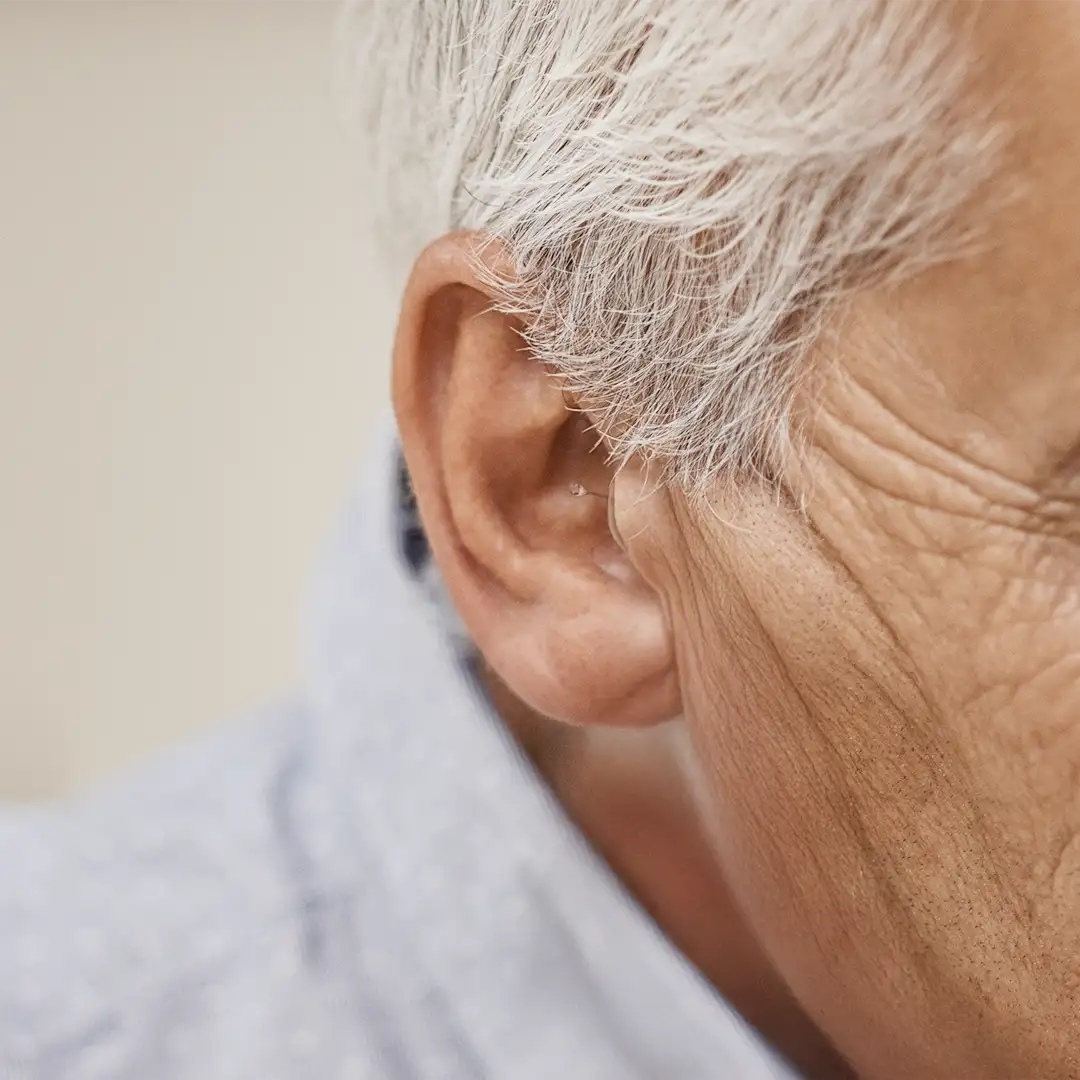 Close-up of an ear with a nearly invisible completely-in-canal hearing aid